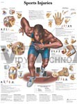 Sports Injuries - Anatomical Chart